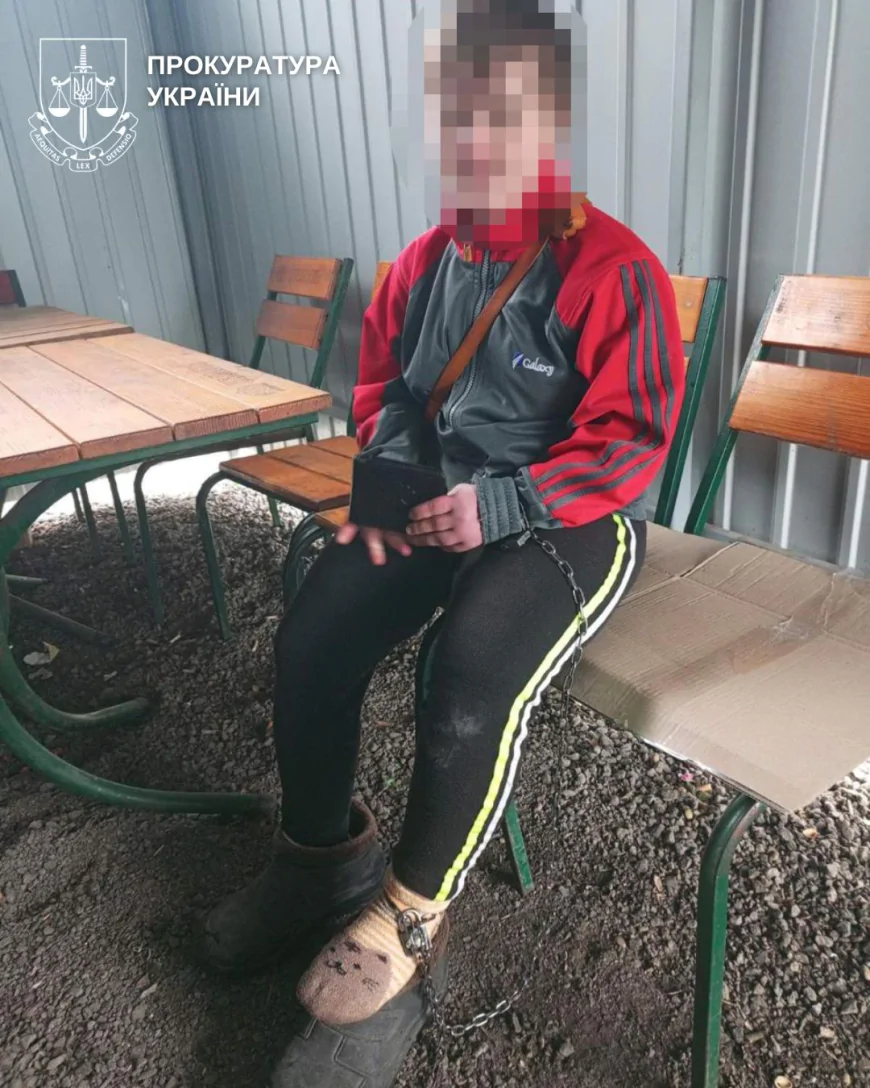 Ланцюги замість турботи: дитина з синдромом Дауна стала жертвою жорстокого поводження